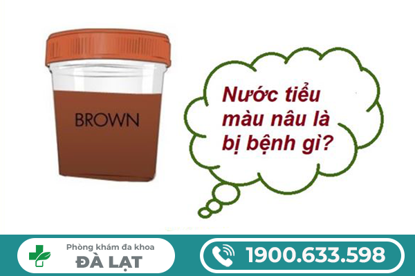 Hình ảnh minh họa